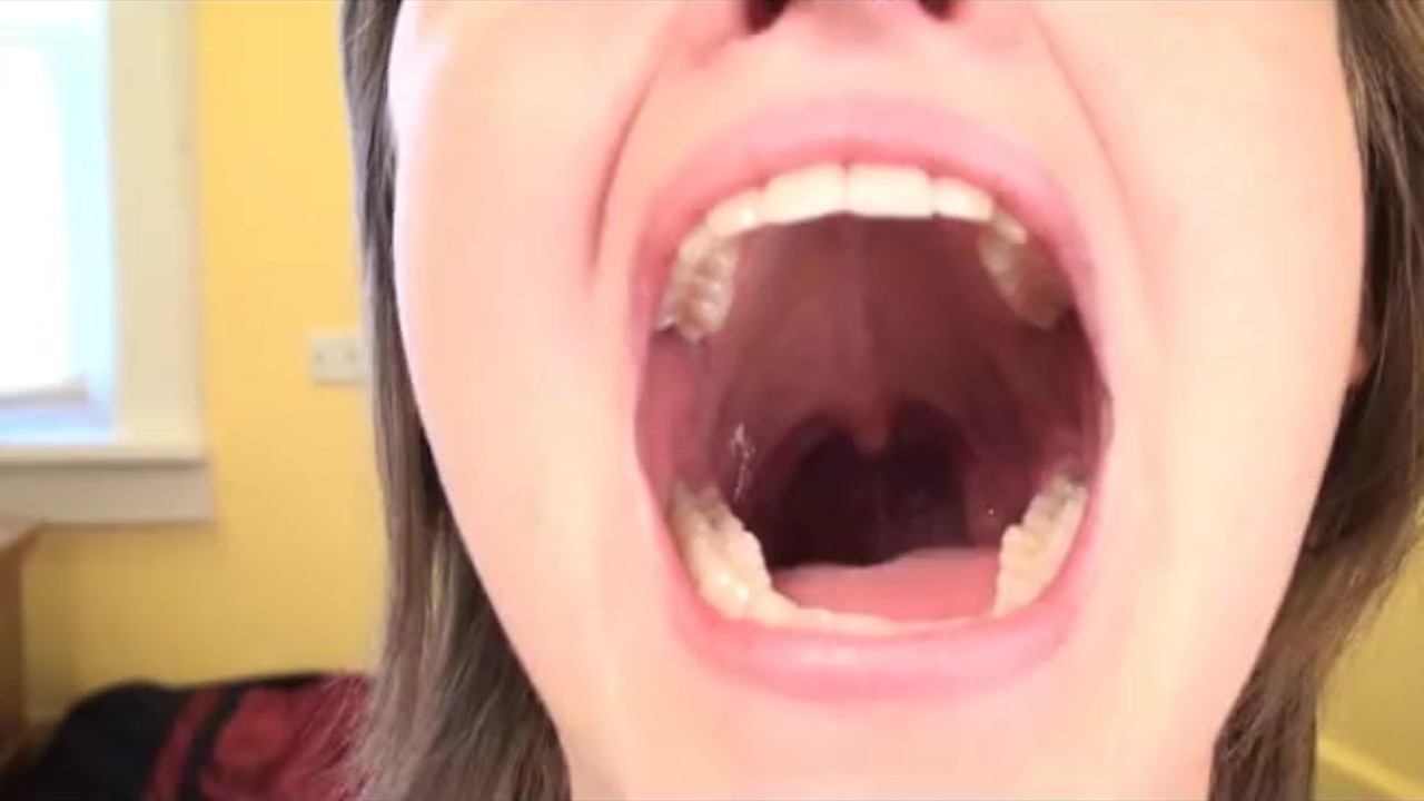 OPEN WIDE MOUTH