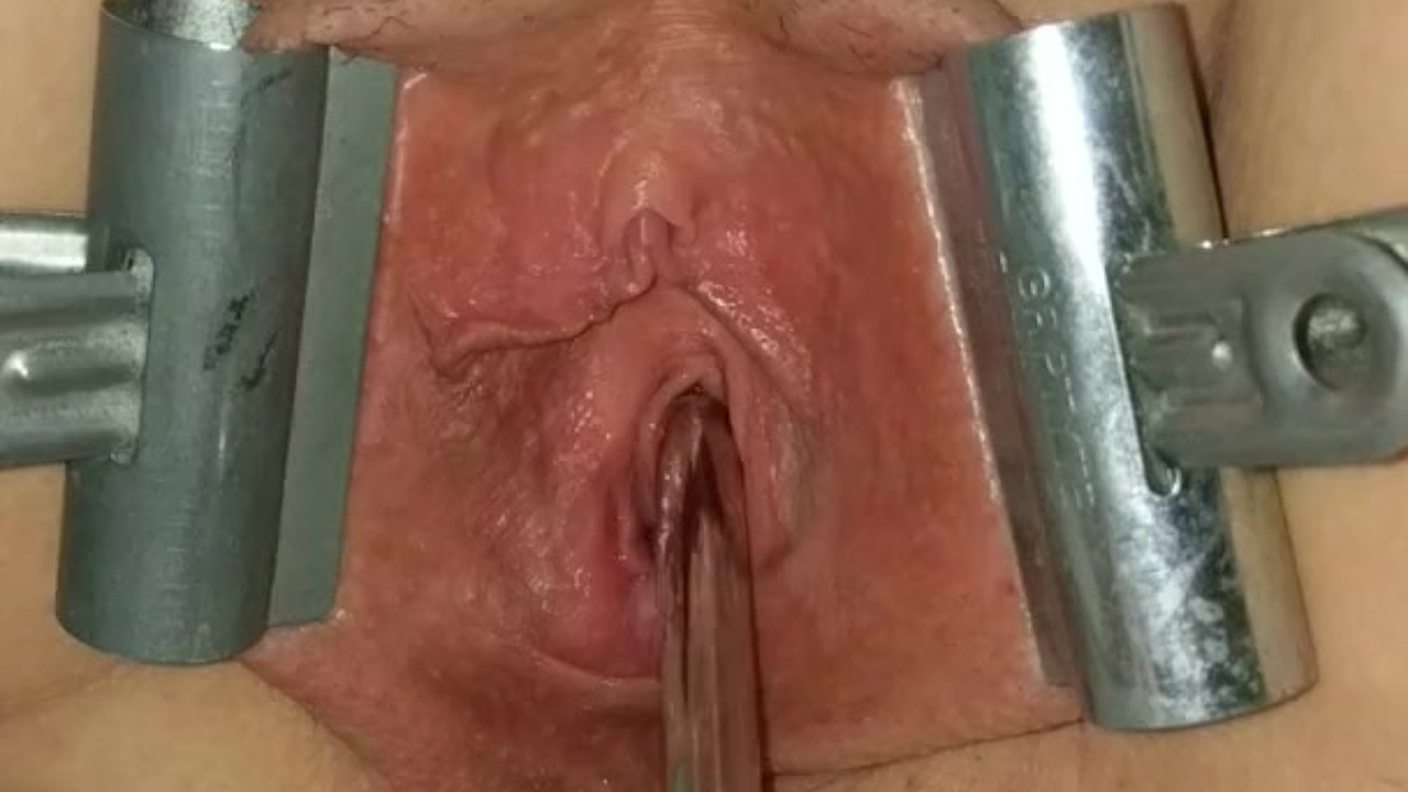 Female Urethral Sounding Orgasm Stretched &amp; Clamped Pussy S&amp;M Medical Play