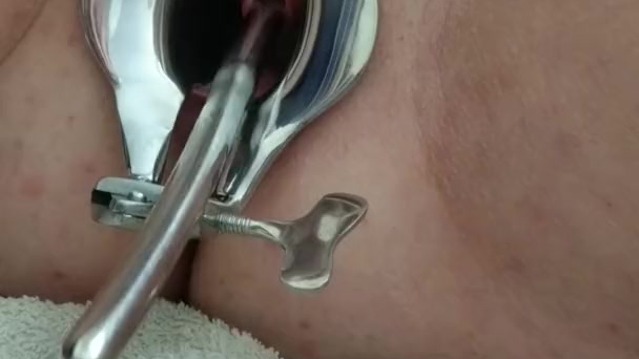 Piss Re-injection - Female Urethral Sounding - BDSM Stretched Wide Peehole