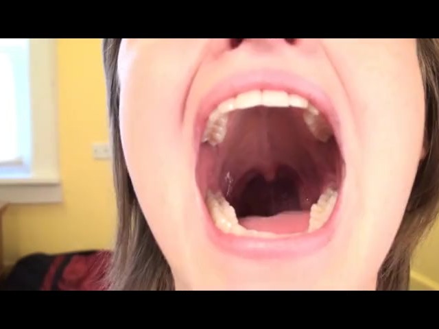 Bad Teeth Bbw Porn - Open Wide Mouth - Free Porn Videos - YouPorn