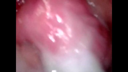 Wife Vagina Cam - Inside Pussy Cam Porn Videos | YouPorn.com