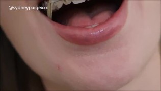 Sydney Paige Teases You to Cum All Over Her Braces 