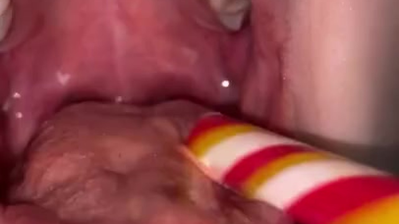 Candy gagging. Xmas underwear. Uvula show