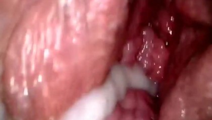 Internal Cumshot Cam - Inside Cam Creamy Pussy - Free Porn Videos - YouPorn